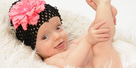Avery was born with Brittle Bone Disease, or Osteogenesis Imperfecta